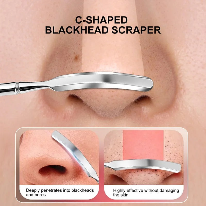 🖤🔧 Blackhead & Pimple Remover Tool – Deep Clean Tweezers